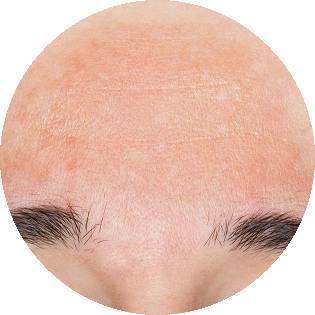 Przyczyny ostudy